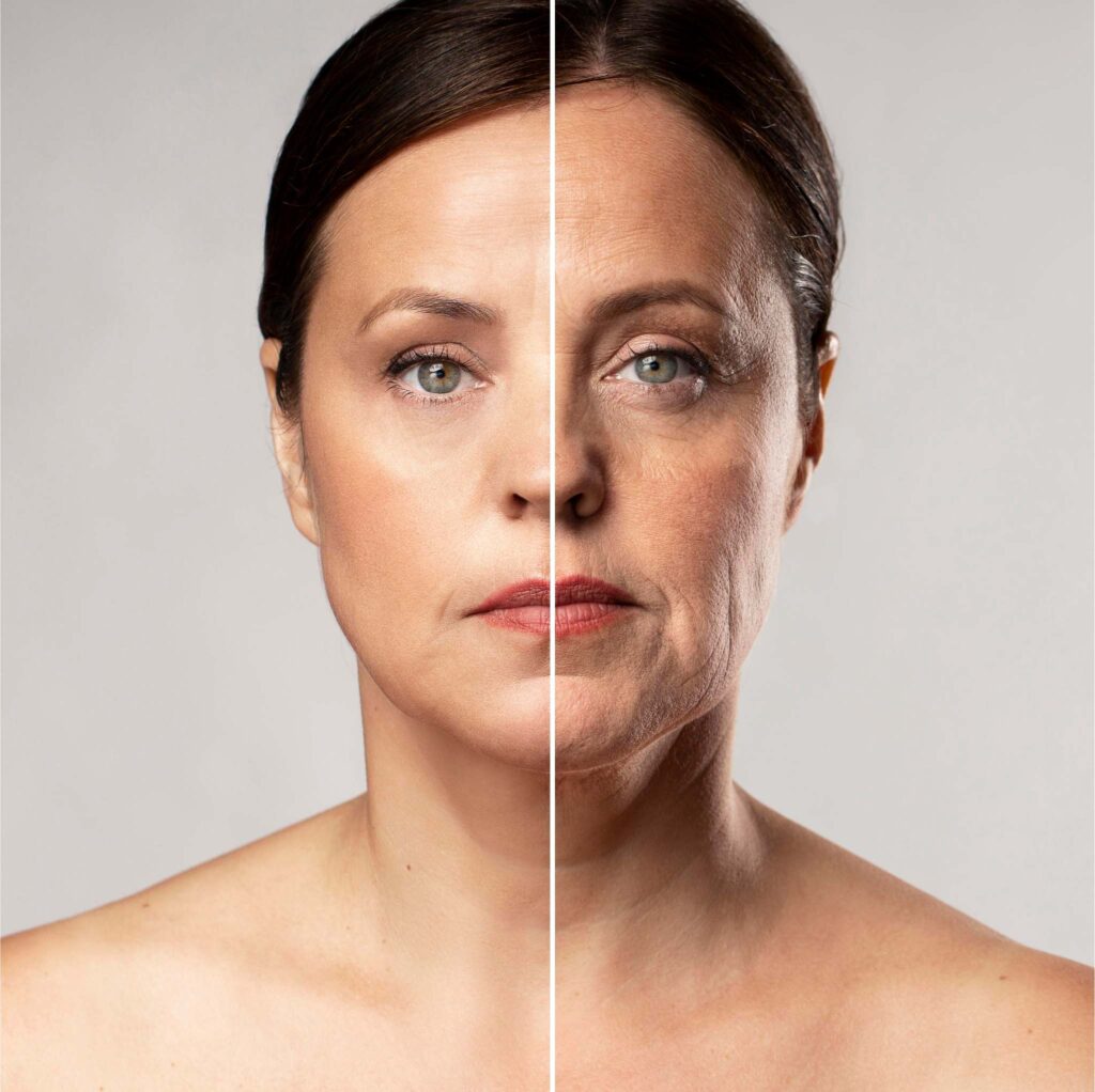 Estética Ibramed - Aparelhos de estética - Tratamentos para rejuvenescimento