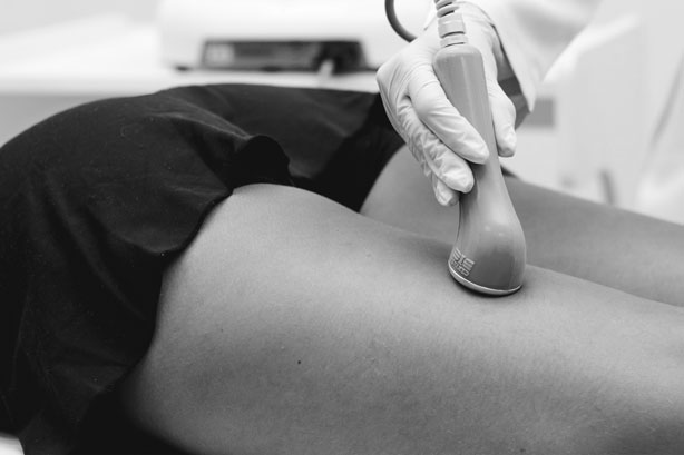 Celulite Posterior de Coxa Ultrassom Sonopulse 1 e 3 MHz