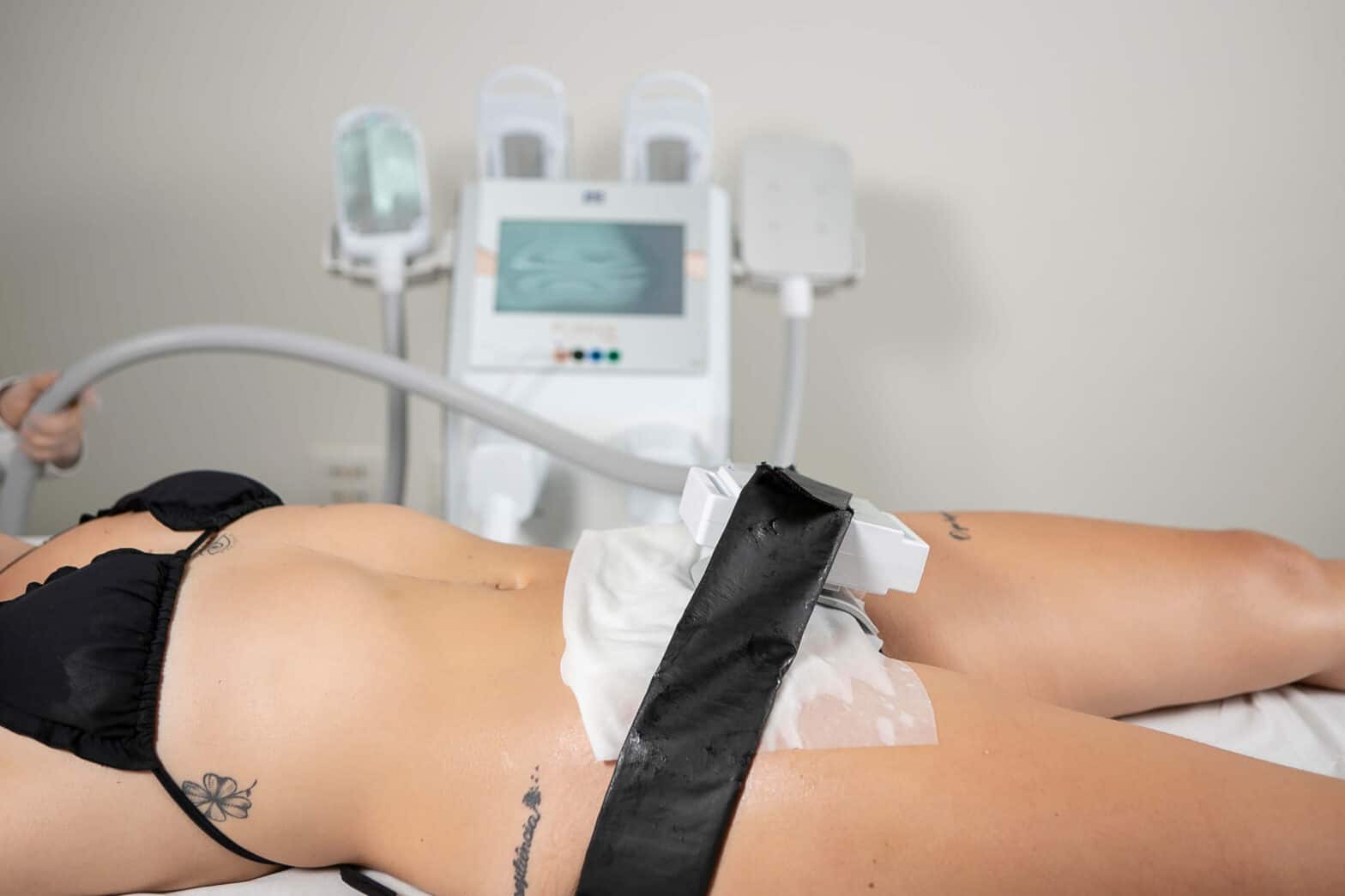 Estética Intima com criolipólise de placas