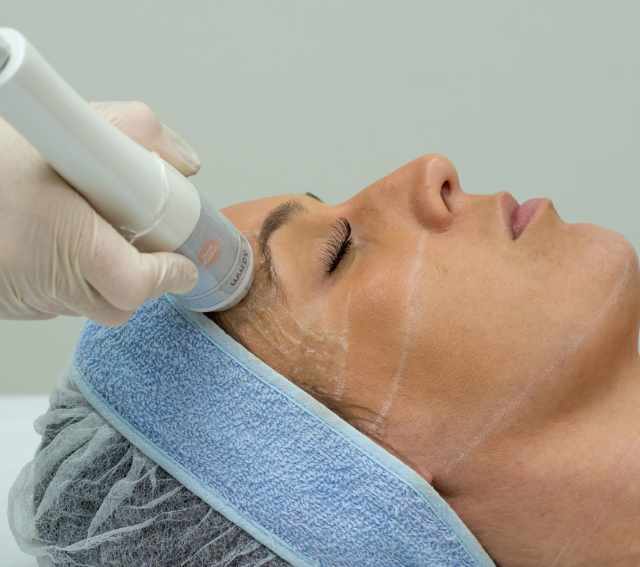 Ultrassom HIFU Microfocado para estética