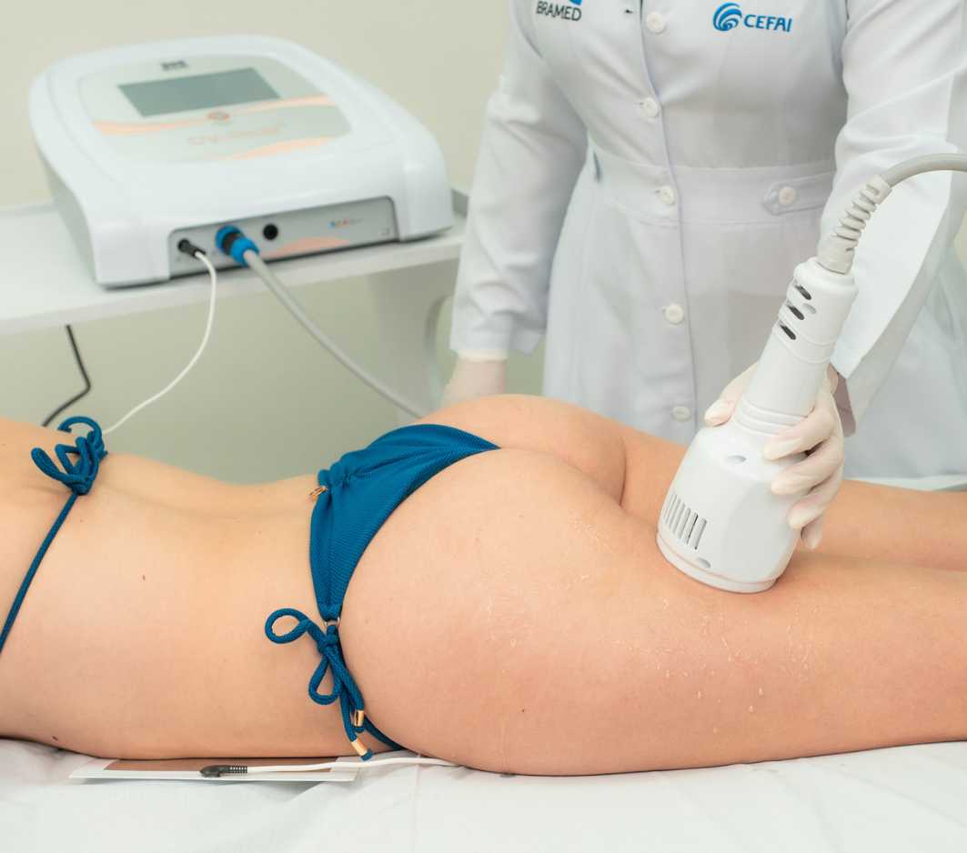 Cryotecar da Ibramed - Criofrequência para tratamentos corporais
