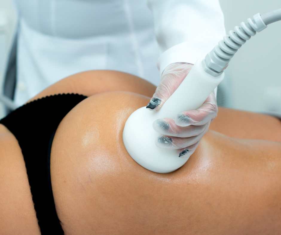 Dermotonus Esthetic para celulites _ Radiofrequência com Vácuo - Tratamento estético não invasivo