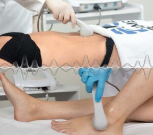 Ultrassom Terapêutico na estética e reabilitação - Guia Completo