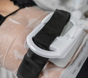 Criolipólise: revisão científica utilizando Polarys
