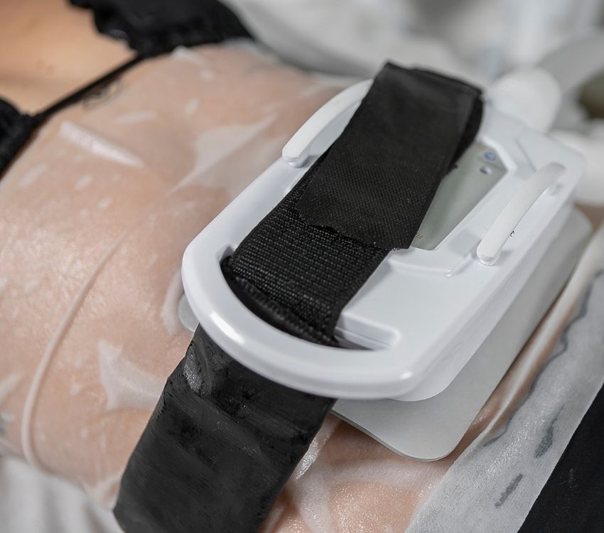 Criolipólise: revisão científica utilizando Polarys