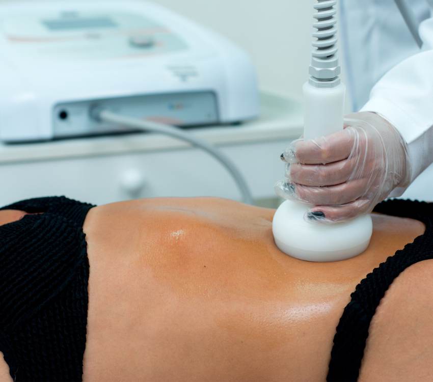 Radiofrequência + Vácuo para gordura localizada com o Dermotonus Esthetic